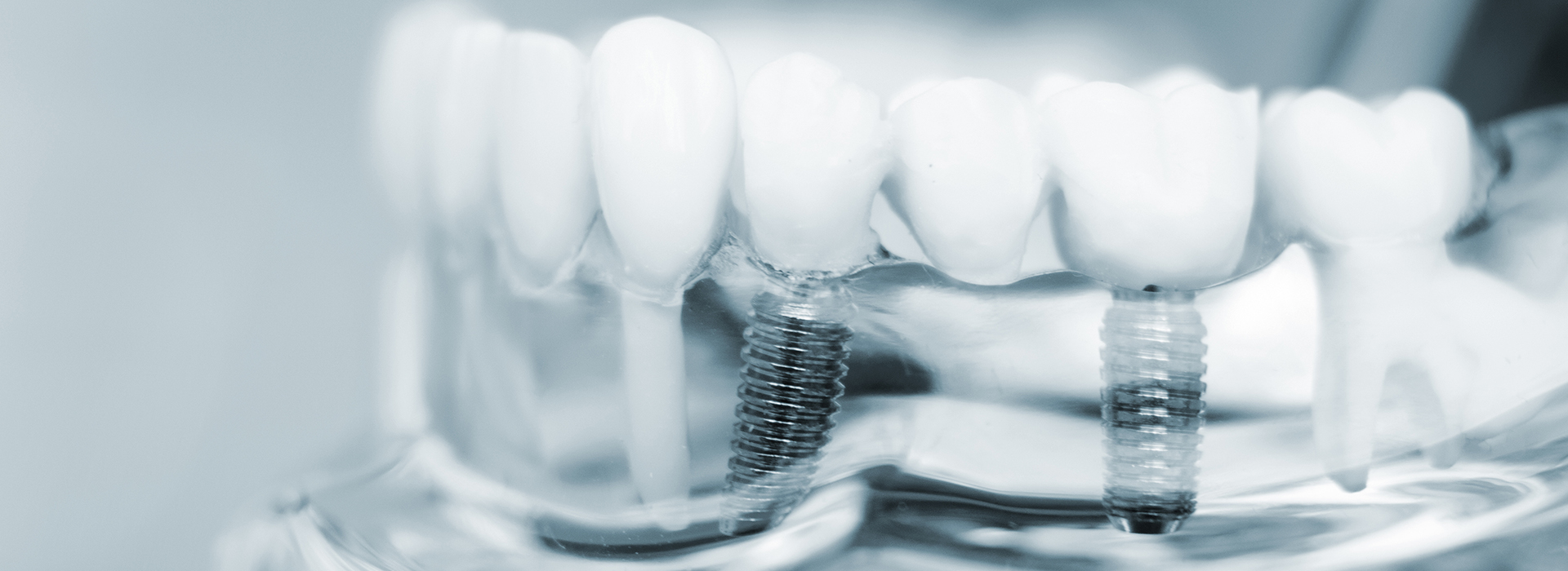 NoblePro Dental | Cosmetic Dentistry, Pediatric Dentistry and Implant Restorations