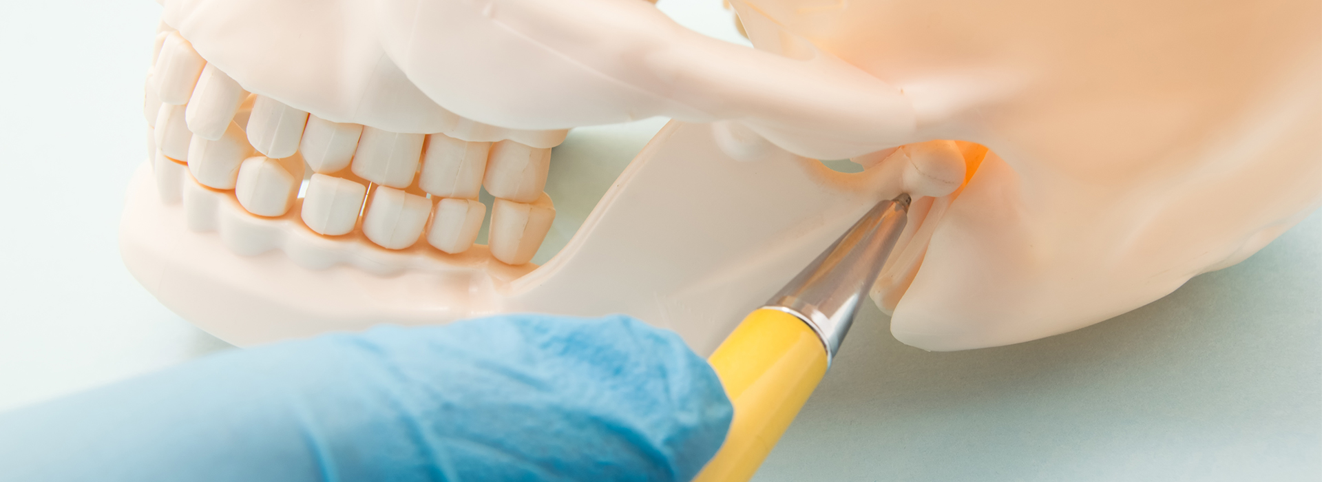 NoblePro Dental | LANAP reg , Inlays  amp  Onlays and Dental Lab