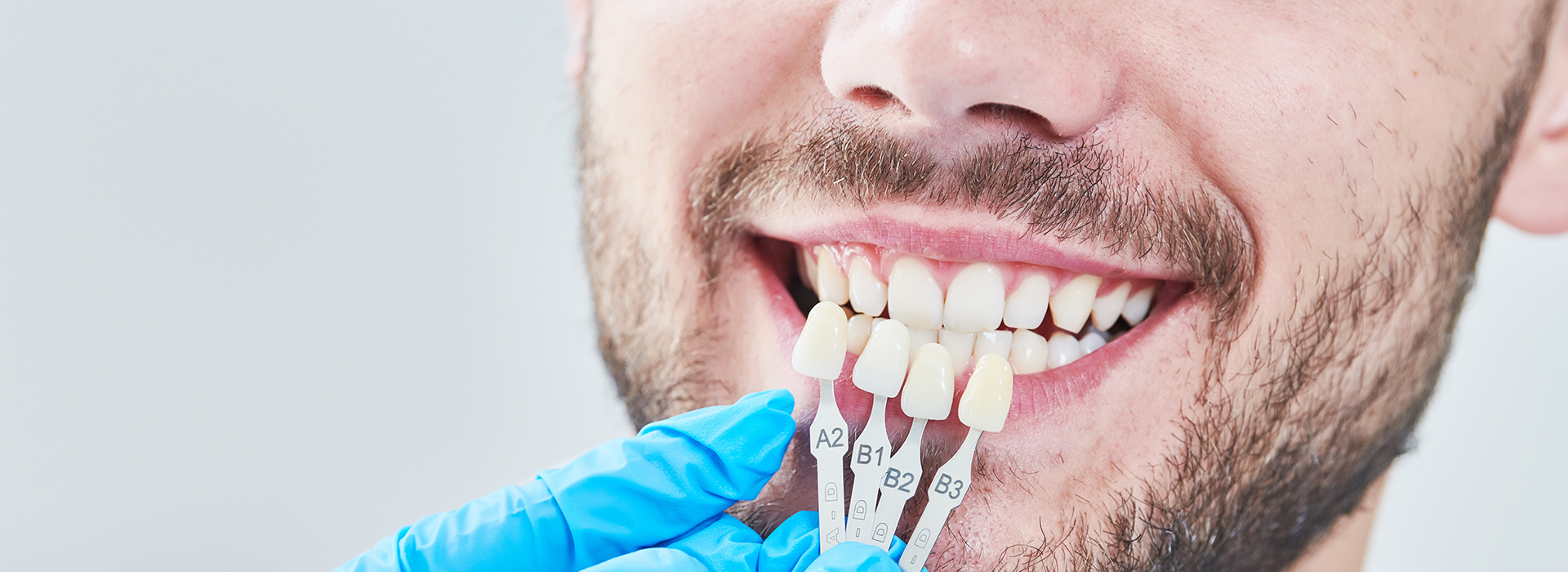 NoblePro Dental | ZOOM  Whitening, Sedation Dentistry and All-on-4 reg 